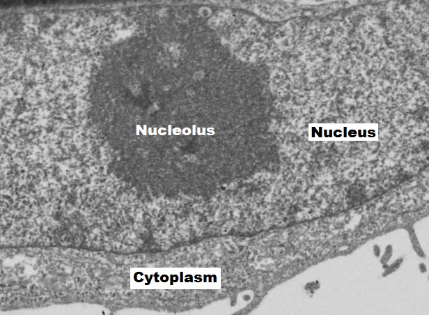 Electron micrograph labelled Nucleolus, Nucleus and Cytoplasm. A dense nucleolus lies inside the nuclear region, above the boundary separating it from cytoplasm.